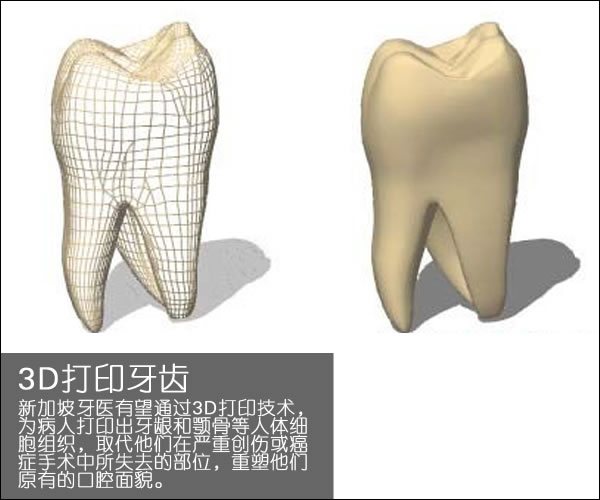 个性化医疗3D打印实战案例与研究成果的问答整理_3d打印服务公司 个性化医疗3D打印实战案例与研究成果的问答整理_3d打印服务公司