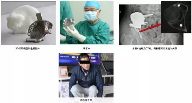 3d打印在医疗领域的应用 3D打印与医疗行业白皮书 3d打印在医疗领域的应用 3D打印与医疗行业白皮书