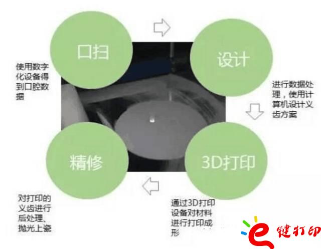 医疗辅助器械的变革之路 3d打印义齿(假牙)前景无限 势在必行_医疗设备器械3d模型打印平台 医疗辅助器械的变革之路 3d打印义齿(假牙)前景无限 势在必行_医疗设备器械3d模型打印平台