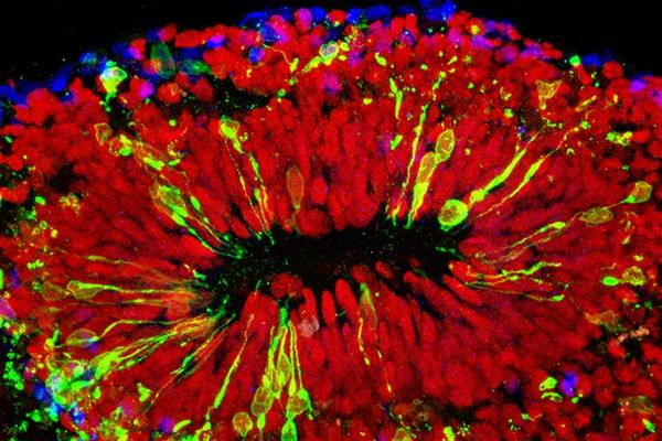 科学家攻克Zika病毒 高中生携3D打印来帮忙

Zika病毒,3D打印医疗行业,3D打印材料价格,3D打印技术,3D打印材料,3D打印成本,3D打印价格