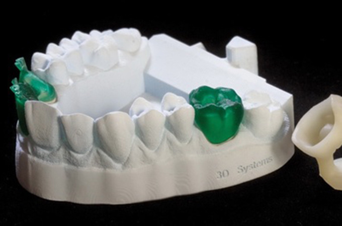 德国率先引入3D打印牙齿技术 全程体验“无痛”种牙-e键打印|3D打印服务
3d打印牙齿,3D打印种牙,无痛种牙,3D打印平台,3D打印服务,南京哪里有3D打印,南京3D打印厂家,南京3D打印服务