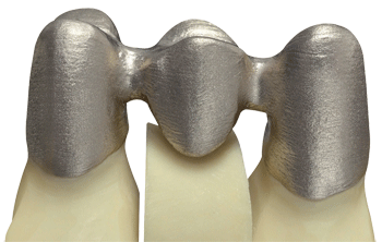 德国率先引入3D打印牙齿技术 全程体验“无痛”种牙-e键打印|3D打印服务
3d打印牙齿,3D打印种牙,无痛种牙,3D打印平台,3D打印服务,南京哪里有3D打印,南京3D打印厂家,南京3D打印服务