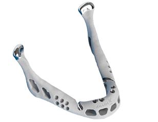 3d打印下颌骨成功移植 置换人体器官不再是梦-e键打印|3D打印服务
医疗3d打印技术,3D打印下颌骨,3D打印人体器官,3D打印器官,3D打印心脏,3D打印假肢,3D打印大脑,3D打印技术,3D打印服务,3D打印云平台