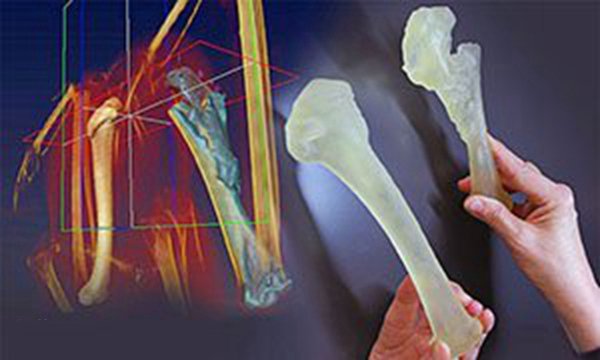 左边是雄鹰健康的肱骨，右边是雄鹰实际受伤的骨头的复制品