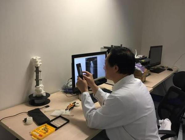3D打印医疗应用成功案例 北医三院3D打印定制人工椎体植入术