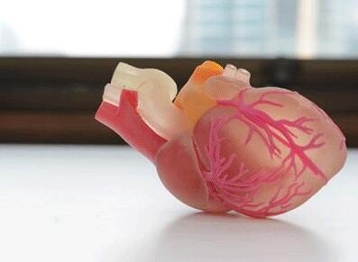 3D打印心脏 3D打印心脏