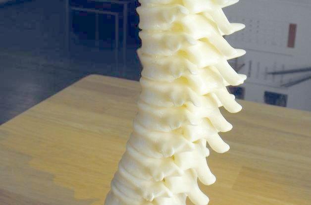 3D打印人体椎骨 3D打印人体椎骨