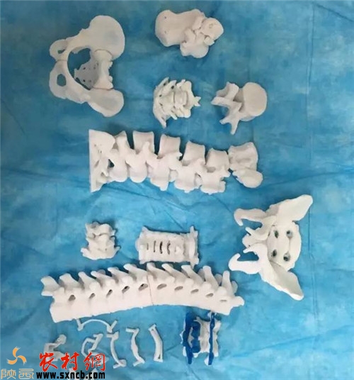 3D打印人体椎骨 3D打印人体椎骨