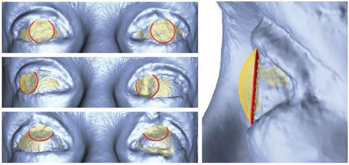 3D打印新技术 迪斯尼用照片重建绘制3D眼部立体图_e键3D打印服务 3D打印新技术 迪斯尼用照片重建绘制3D眼部立体图_e键3D打印服务