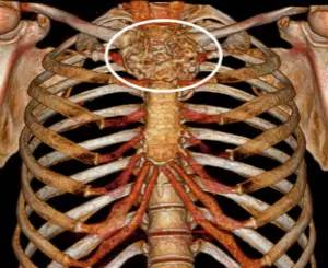 第四军医大学精彩分享个性化医疗3D打印的实战案例与研究成果