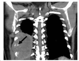 第四军医大学精彩分享个性化医疗3D打印的实战案例与研究成果