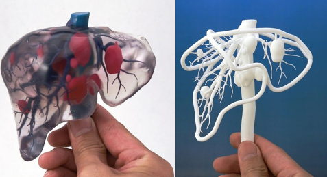 个性化医疗3D打印实战案例与研究成果的问答整理_3d打印服务公司 个性化医疗3D打印实战案例与研究成果的问答整理_3d打印服务公司
