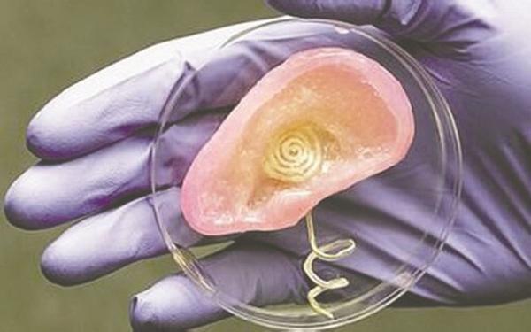 3d打印应用案例:3D打印人体器官的那些事儿 3d打印应用案例:3D打印人体器官的那些事儿