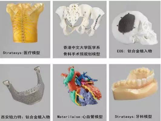 3d打印在医疗领域的应用 3D打印与医疗行业白皮书 3d打印在医疗领域的应用 3D打印与医疗行业白皮书