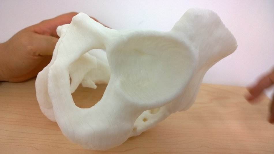 3d打印应用领域之医疗应用_e键打印服务公司