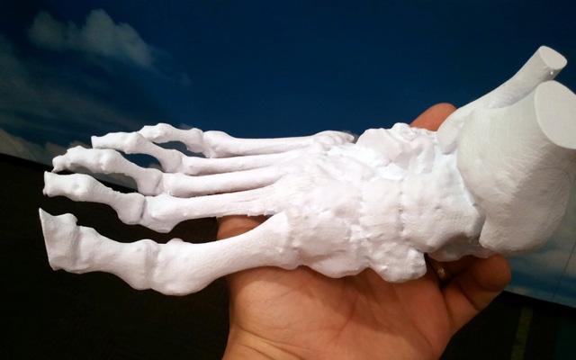 3d打印应用领域之医疗应用_e键打印服务公司