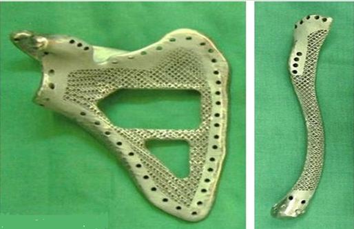 3d打印应用领域之医疗应用_e键打印服务公司