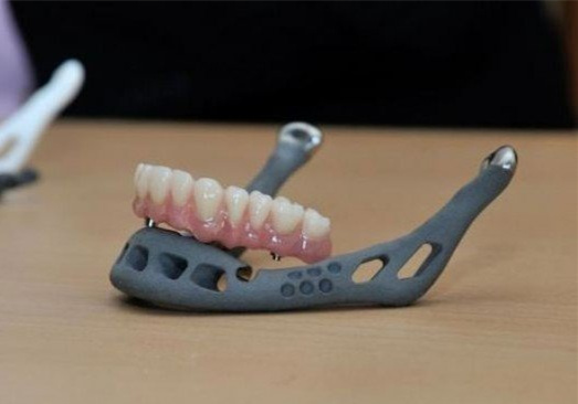 医疗3D打印的假牙 新手选择3D打印手板模型加工打样还是CNC加工?选择当地还是全国3D打印公司? 医疗3D打印的假牙 新手选择3D打印手板模型加工打样还是CNC加工?选择当地还是全国3D打印公司?