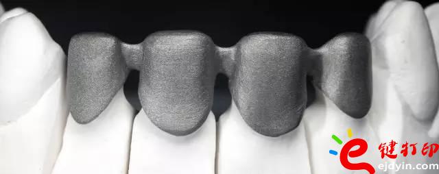 医疗辅助器械的变革之路 3d打印义齿(假牙)前景无限 势在必行_医疗设备器械3d模型打印平台 医疗辅助器械的变革之路 3d打印义齿(假牙)前景无限 势在必行_医疗设备器械3d模型打印平台