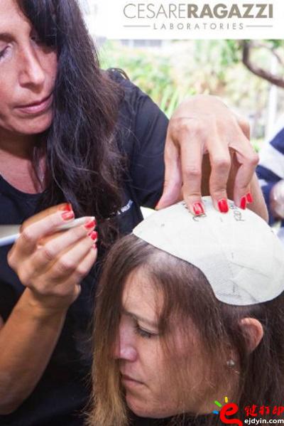 另类治疗脱发的最好方法 用3D打印超逼真假发解决困扰 治疗脱发不再烦,3d打印头发,假发3d模型,3d打印材料,3d打印服务,3d打印厂家 另类治疗脱发的最好方法 用3D打印超逼真假发解决困扰 治疗脱发不再烦,3d打印头发,假发3d模型,3d打印材料,3d打印服务,3d打印厂家