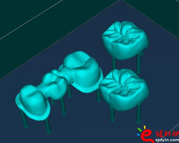 3d打印牙齿价格,3d打印牙齿模型,3d打印牙齿临床了吗,3d打印牙齿价格表,3d打印牙齿能用多久 3d打印牙齿价格,3d打印牙齿模型,3d打印牙齿临床了吗,3d打印牙齿价格表,3d打印牙齿能用多久