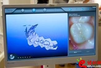 3d打印牙齿价格,3d打印牙齿模型,3d打印牙齿临床了吗,3d打印牙齿价格表,3d打印牙齿能用多久 3d打印牙齿价格,3d打印牙齿模型,3d打印牙齿临床了吗,3d打印牙齿价格表,3d打印牙齿能用多久