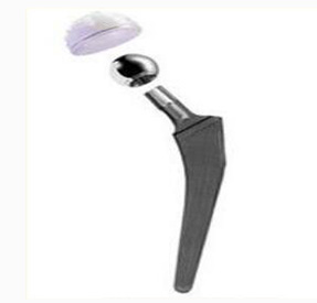 股骨金属植入物4