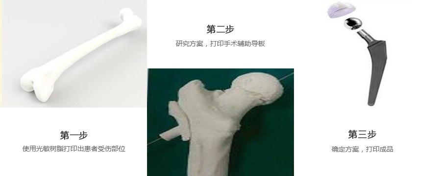 股骨金属植入物3d打印制作流程