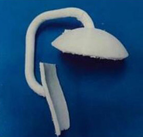 肩关节金属植入物4